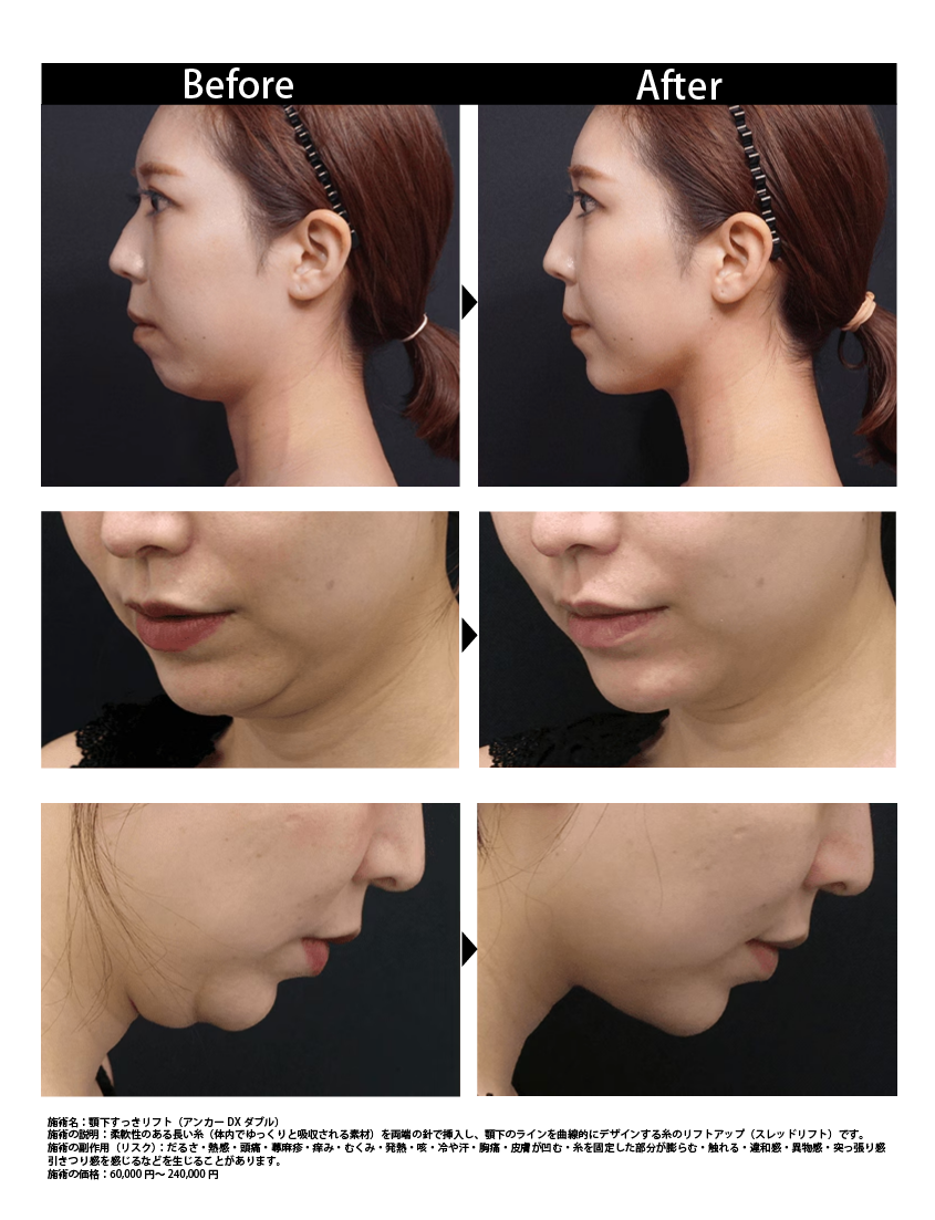 症例写真をご紹介☆