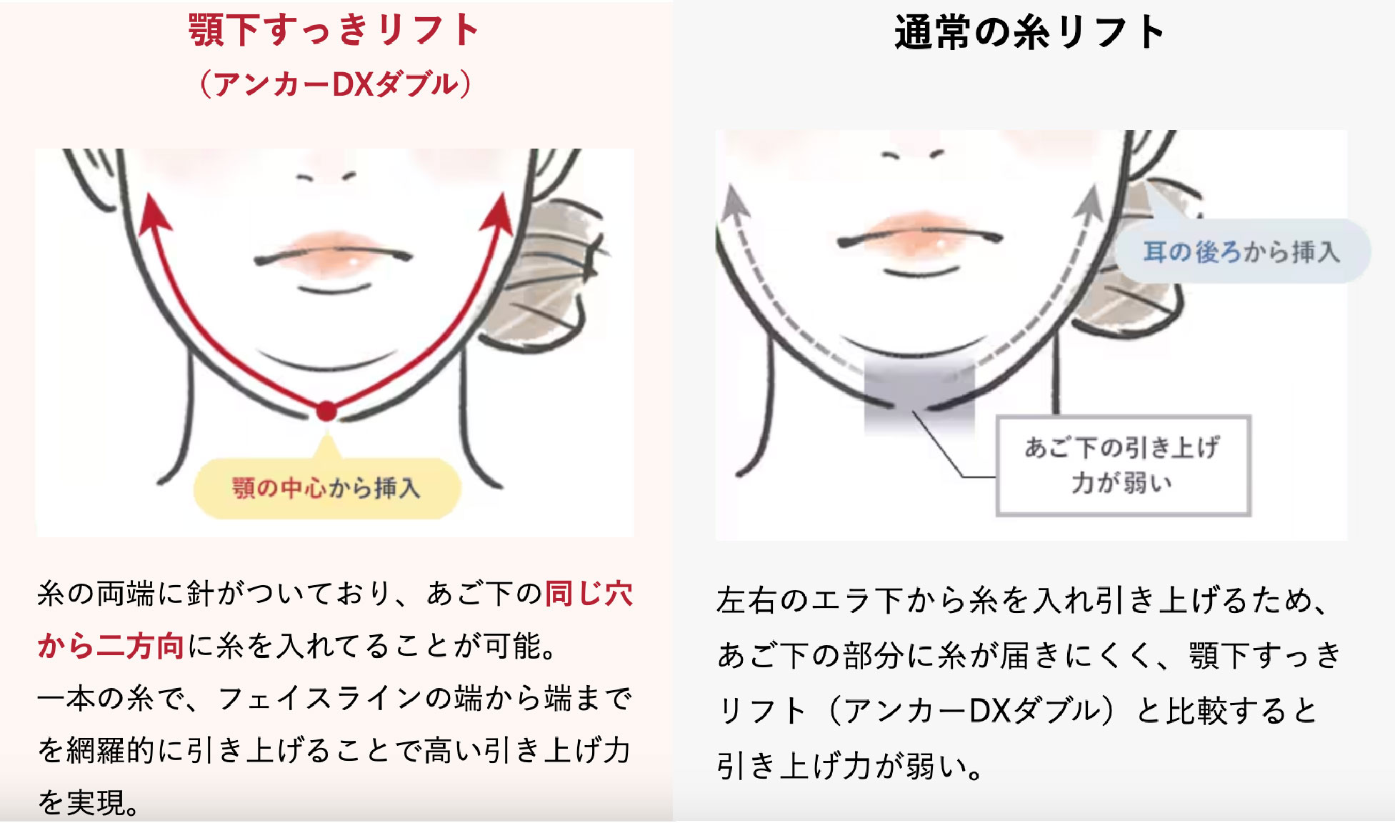 他の糸と何が違うの？