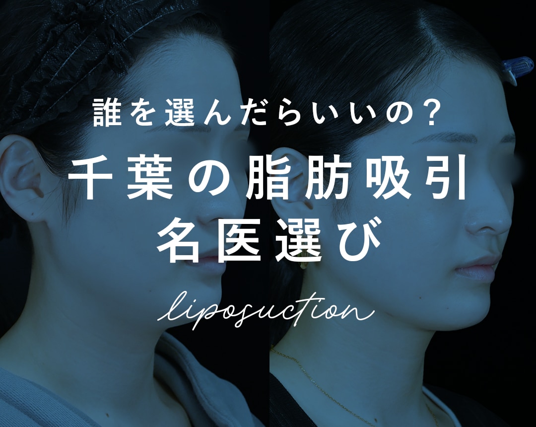 【2026年最新】千葉県で後悔しない脂肪吸引を受けるための「絶対基準」｜名医の選び方と症例実績を医師が解説