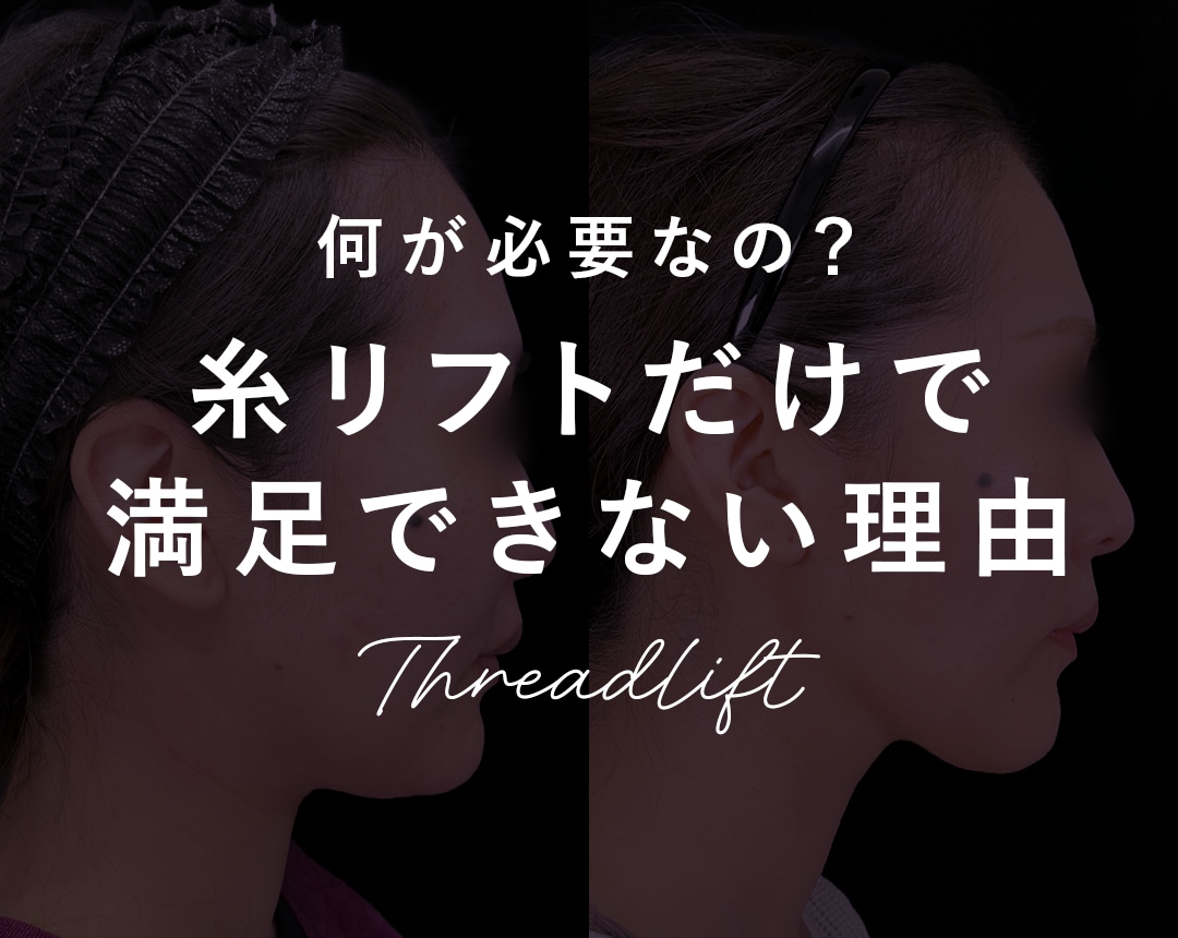 【2026年最新】千葉県で後悔しない顔の脂肪吸引を受けるための「3つの絶対基準」｜糸リフトとの相乗効果を院長が解説