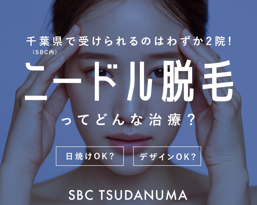 【2026最新】千葉県でわずか2院。希少な「医療ニードル脱毛」が選ばれる3つの理由｜湘南美容クリニック津田沼院