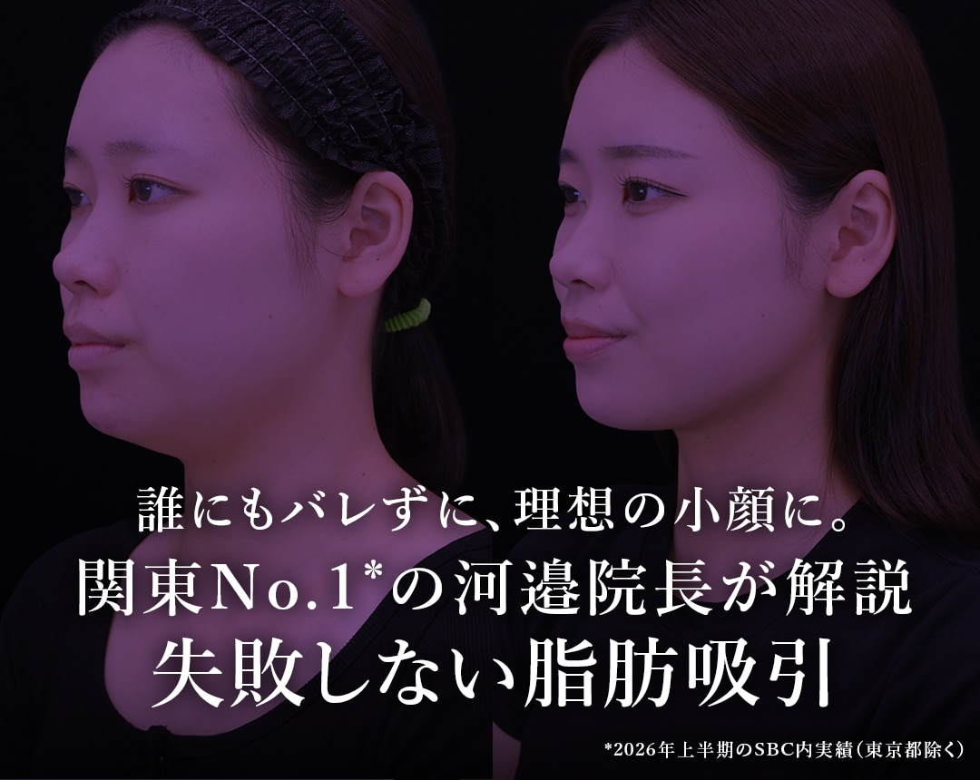 【2026年最新】千葉県で顔の脂肪吸引ならSBC津田沼院｜関東No.1実績の河邉院長が失敗しない顔の脂肪吸引について徹底解説
