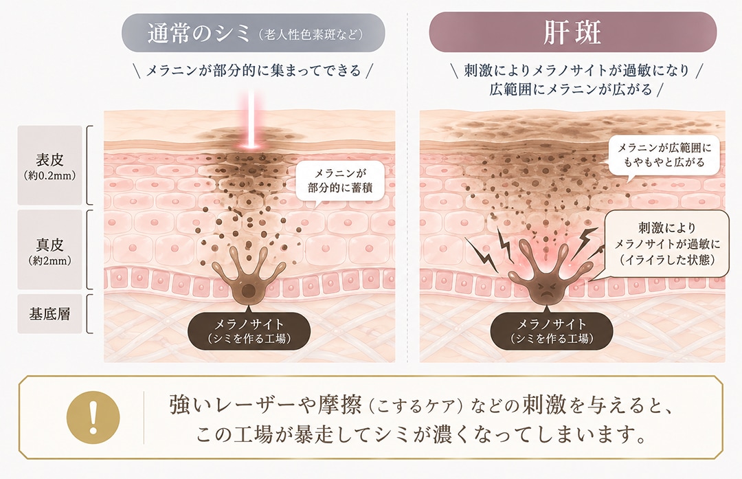 肝斑があるけど毛穴・肌質も改善したい方へ