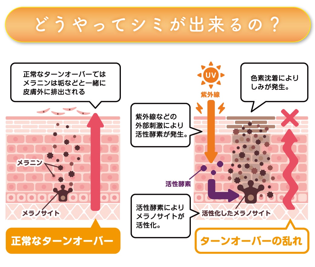 シミができる原因
