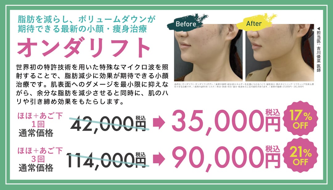 ※2026年5月末まで※