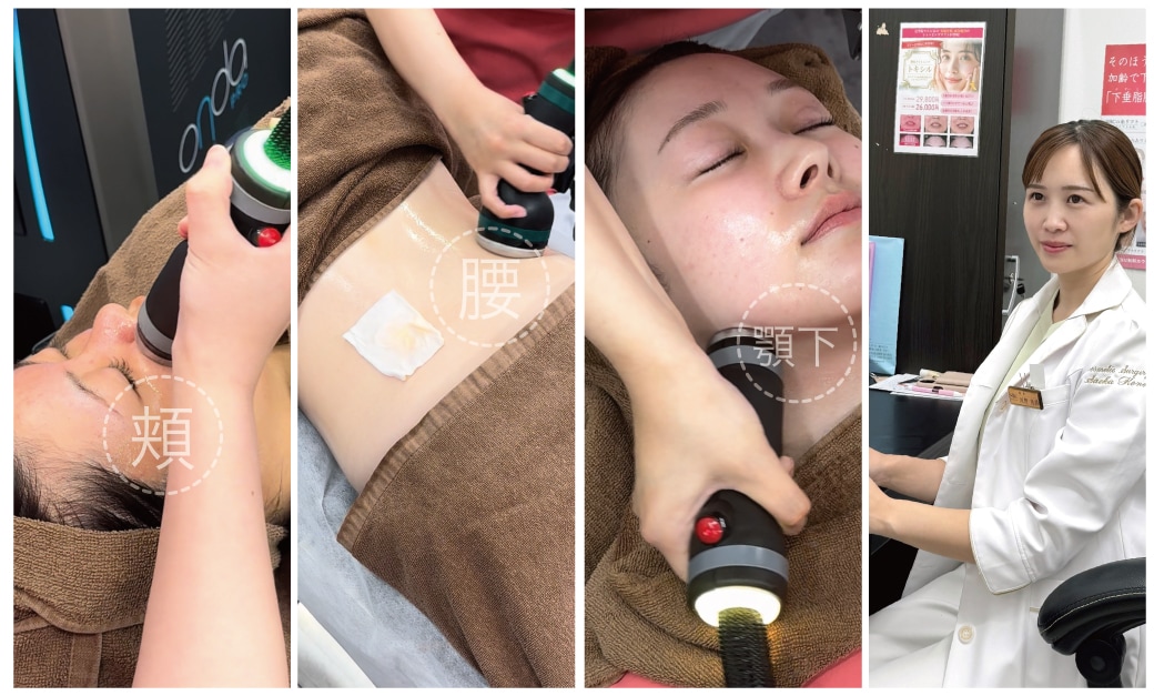 オンダリフトってどんな施術？