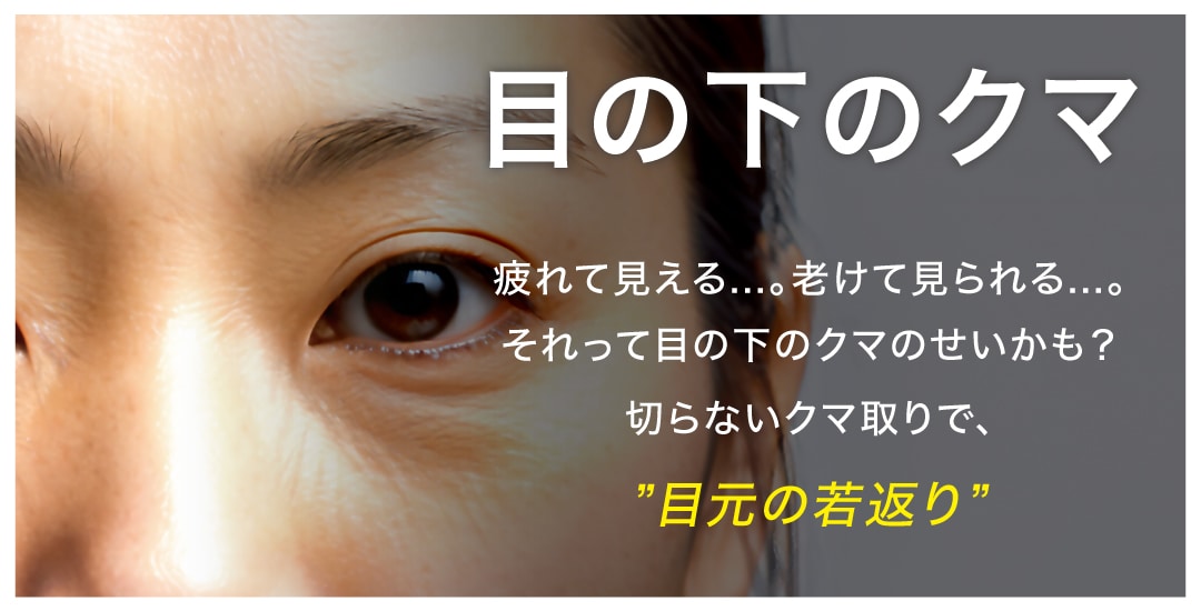 目の下のクマにお悩みの方へ