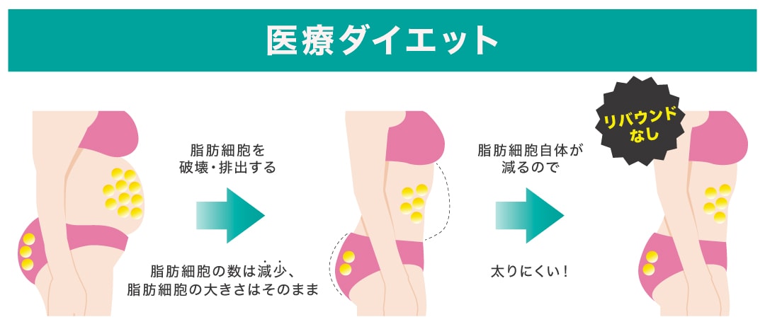 医療ダイエットでは