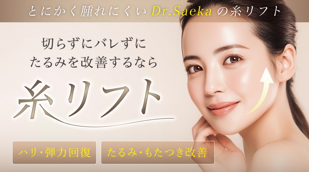 糸リフト