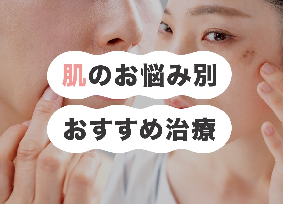 あなたのお肌の悩みをサポート！自分にピッタリな治療が見つかるかも！✨