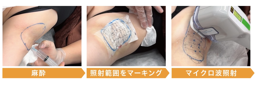 施術の流れ