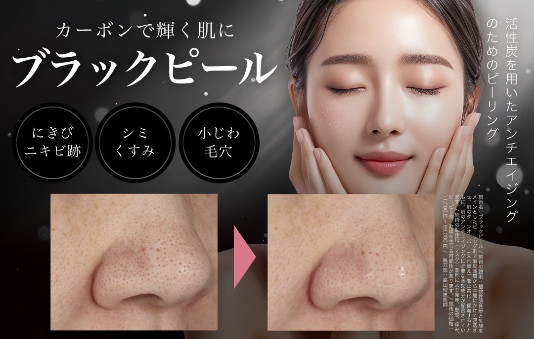 ブラックピール