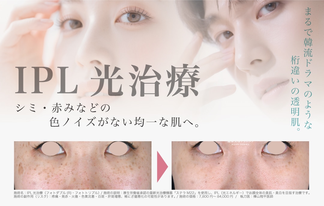 フォトダブル・フォトトリプル