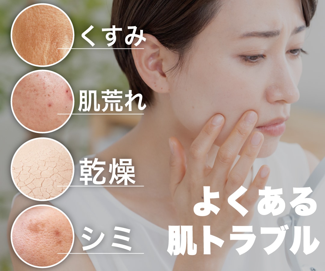 肌荒れしやすい季節