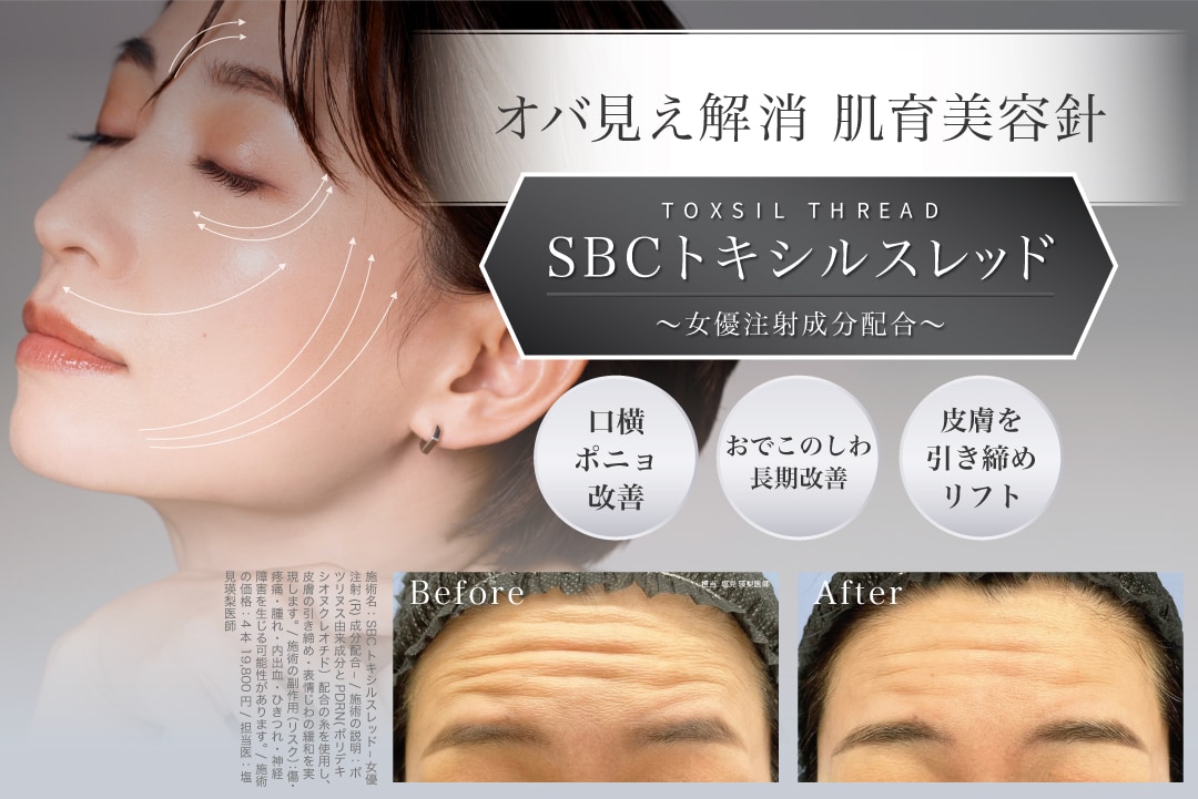 SBCトキシルスレッド