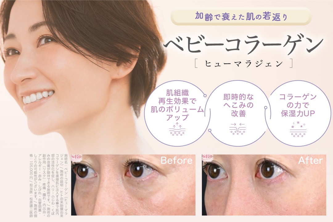 ベビーコラーゲン