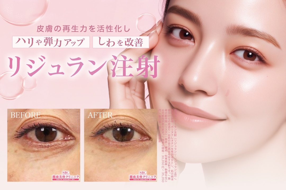 リジュラン注射