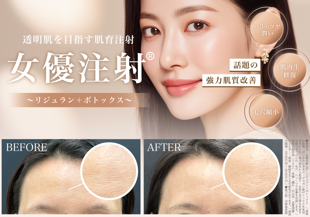 女優注射