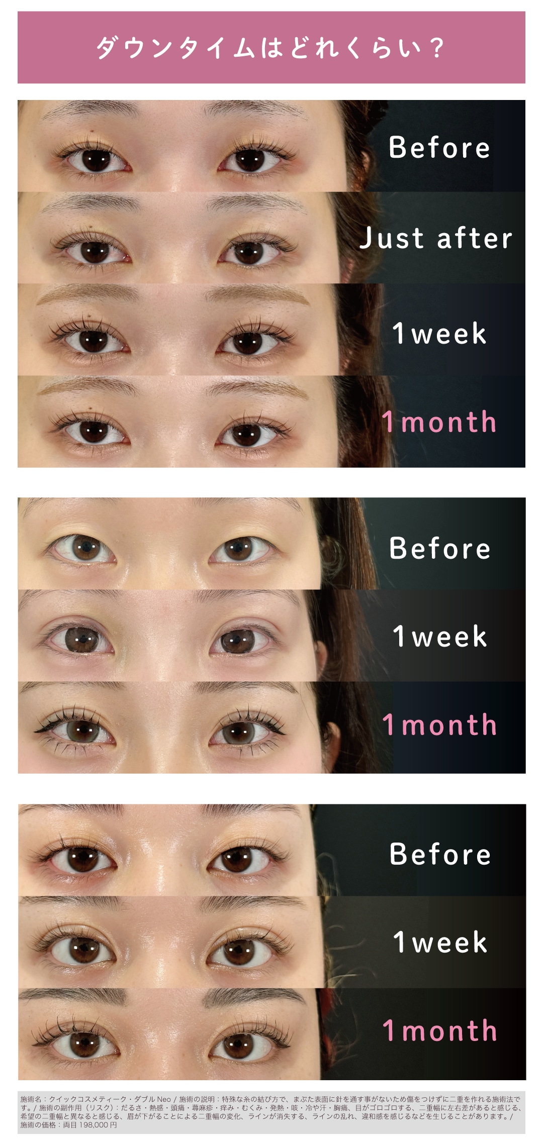 ダウンタイムの様子