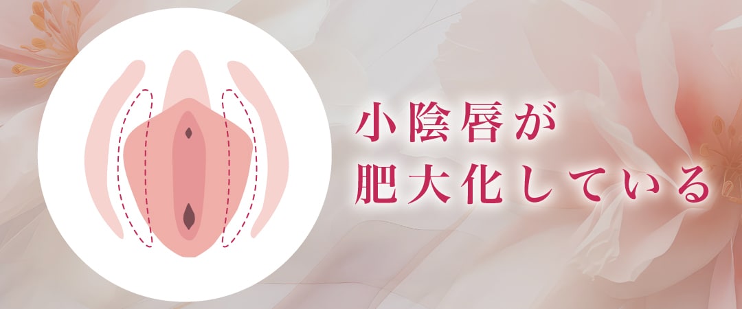 小陰唇が肥大化している