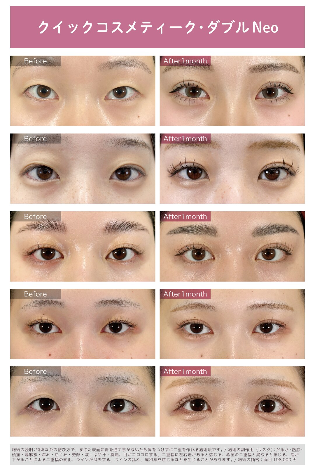 ナチュラル二重もパッチリ二重も、さえか先生にお任せ！