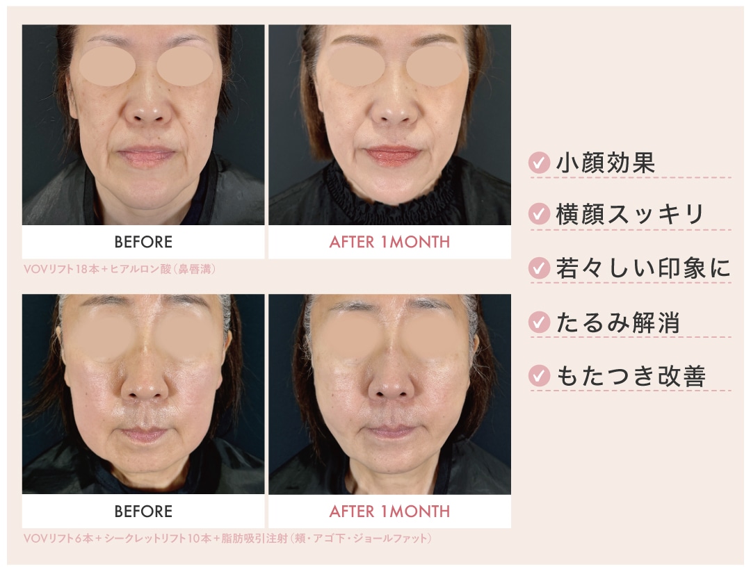 見た目年齢若返り✨