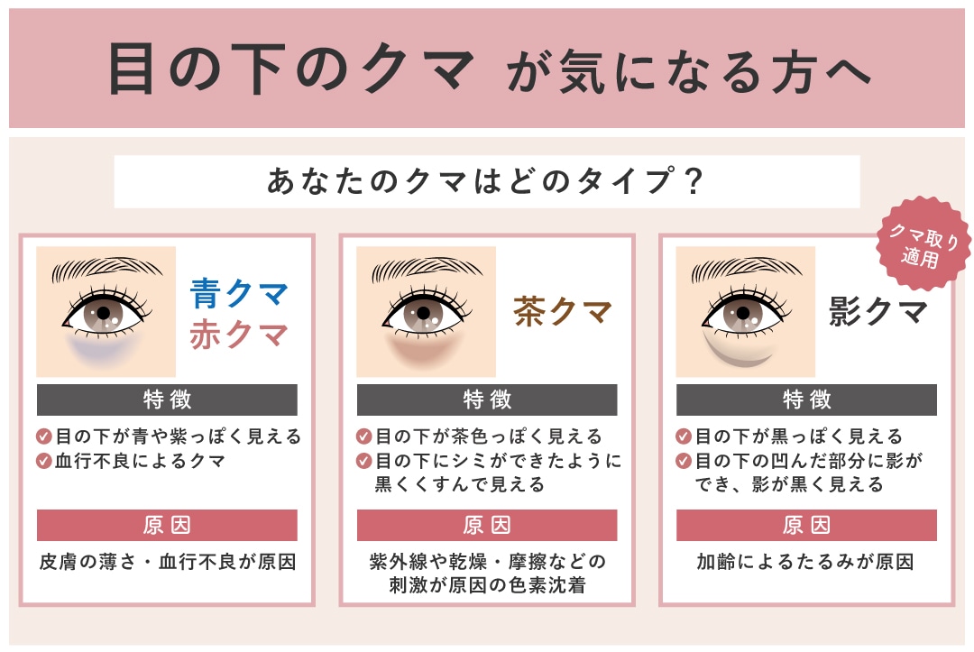 あなたのクマはどのタイプ？