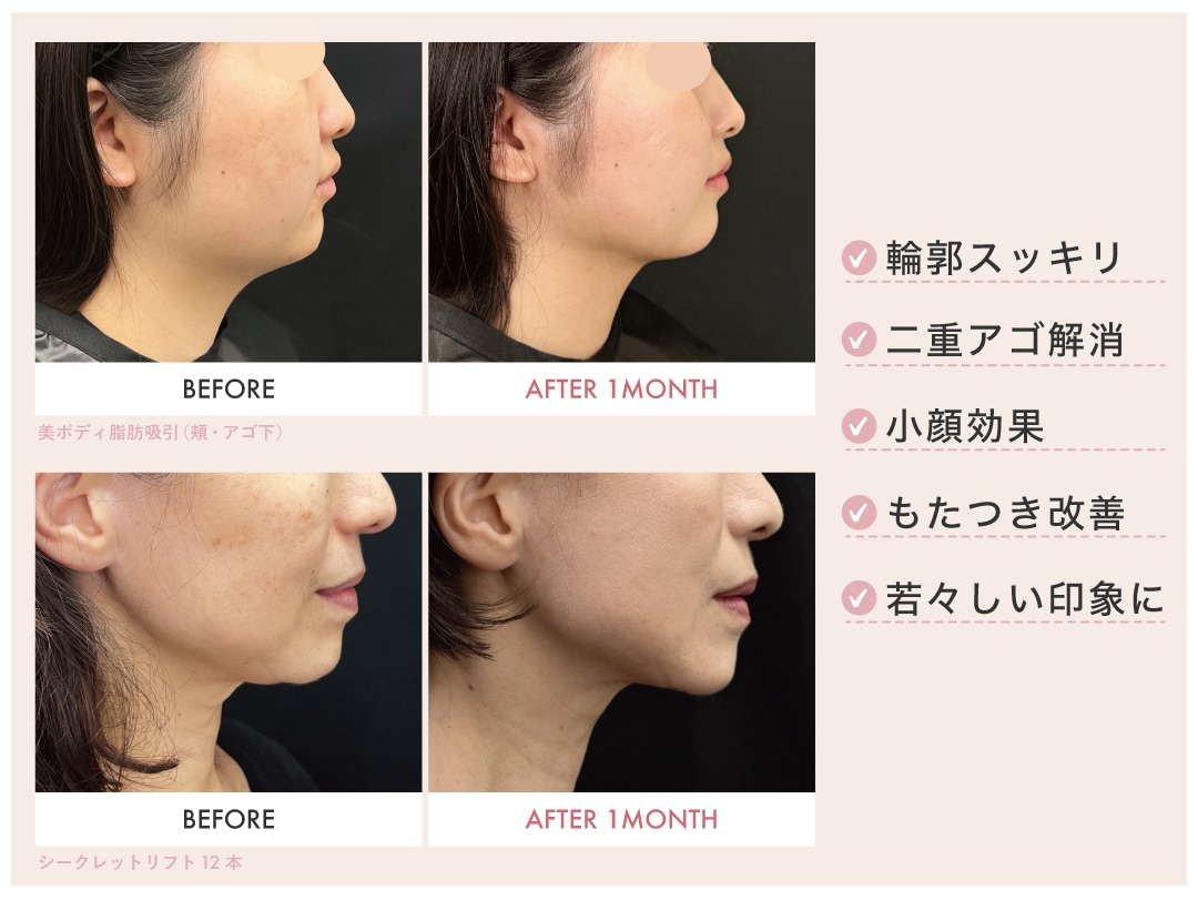 横顔美人で若々しい印象に✨