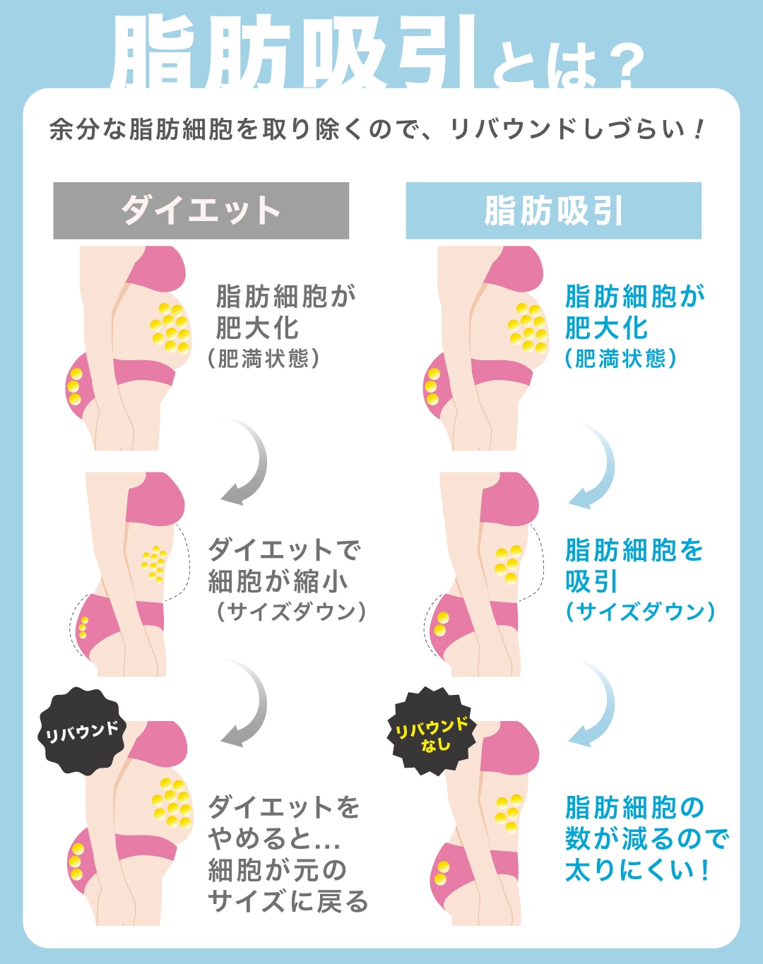 余分な脂肪を吸引し、輪郭・ボディラインを整える