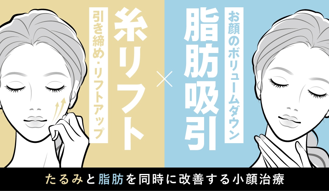 小顔効果・若返り効果を高める組み合わせ治療について解説！