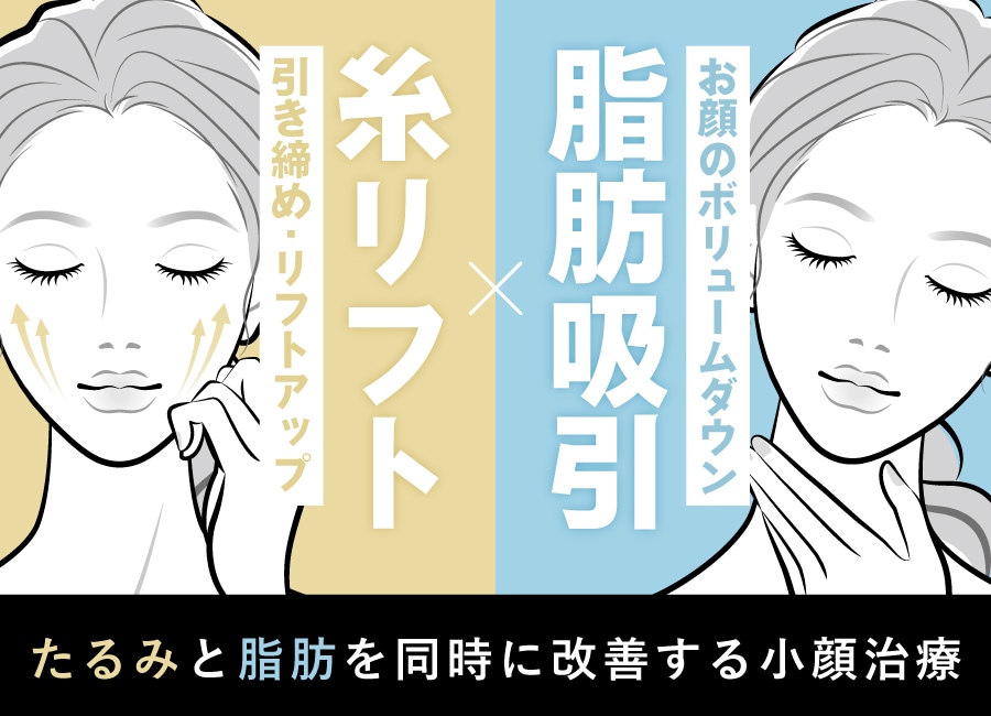 糸リフトと脂肪吸引の併用治療とは？見た目年齢マイナス10歳の若返り治療✨