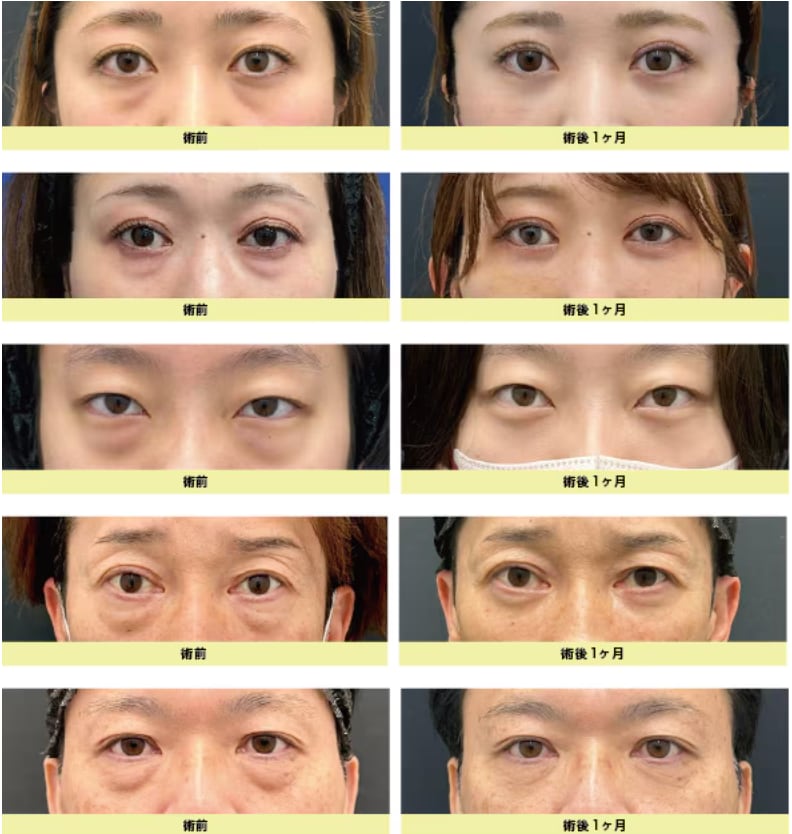 術後の変化をしっかり実感！