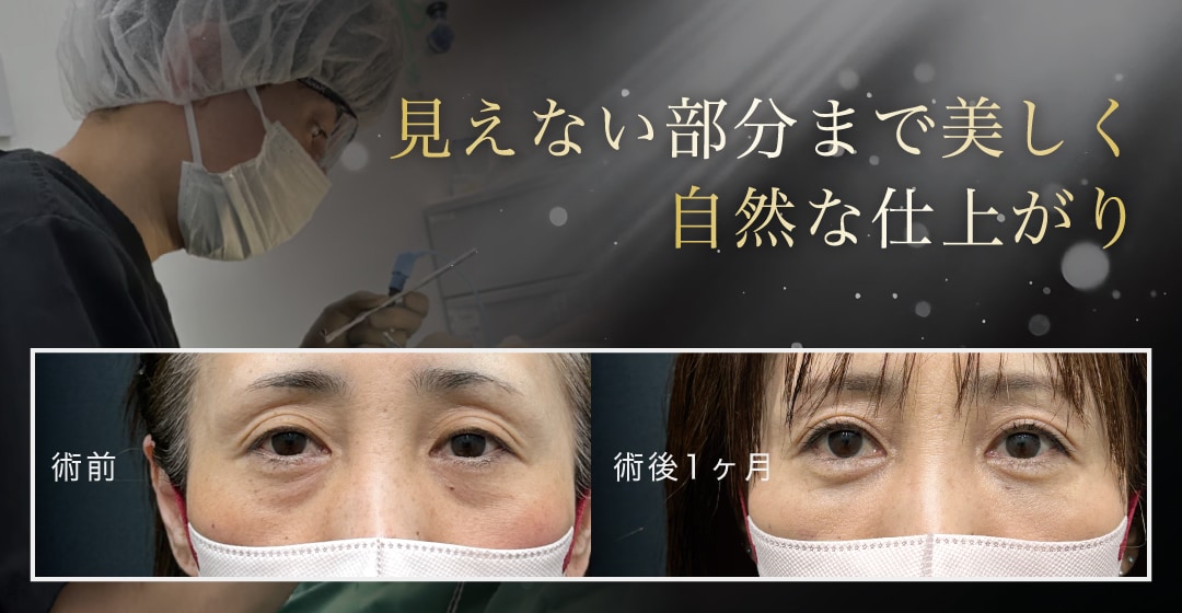 見えない内部まで美しく。