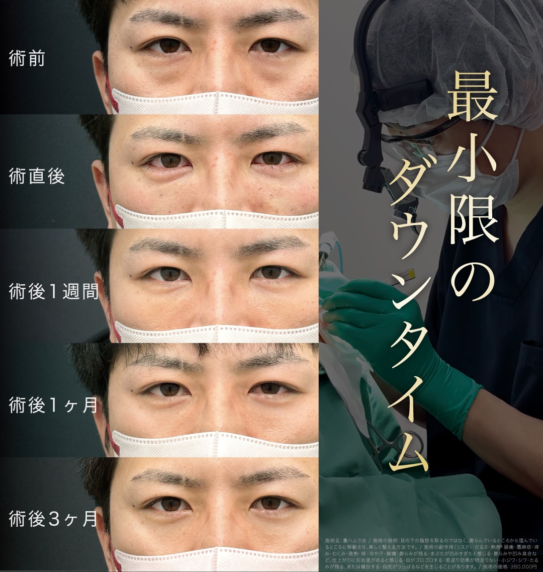 最小限のダウンタイム