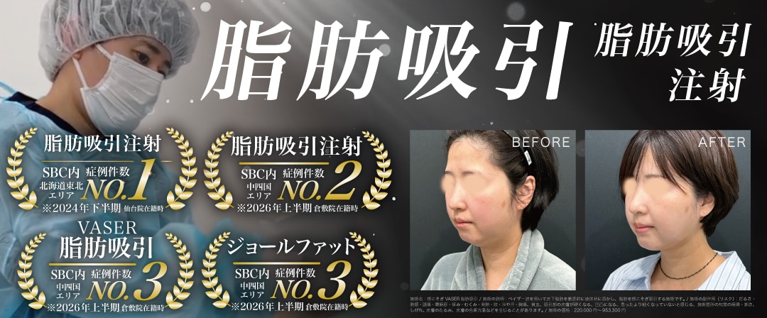 脂肪吸引で選ばれる茂木院長
