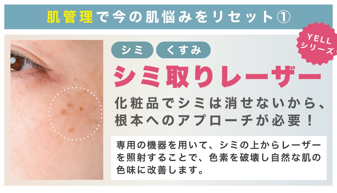シミが気になるなら「シミ取り」