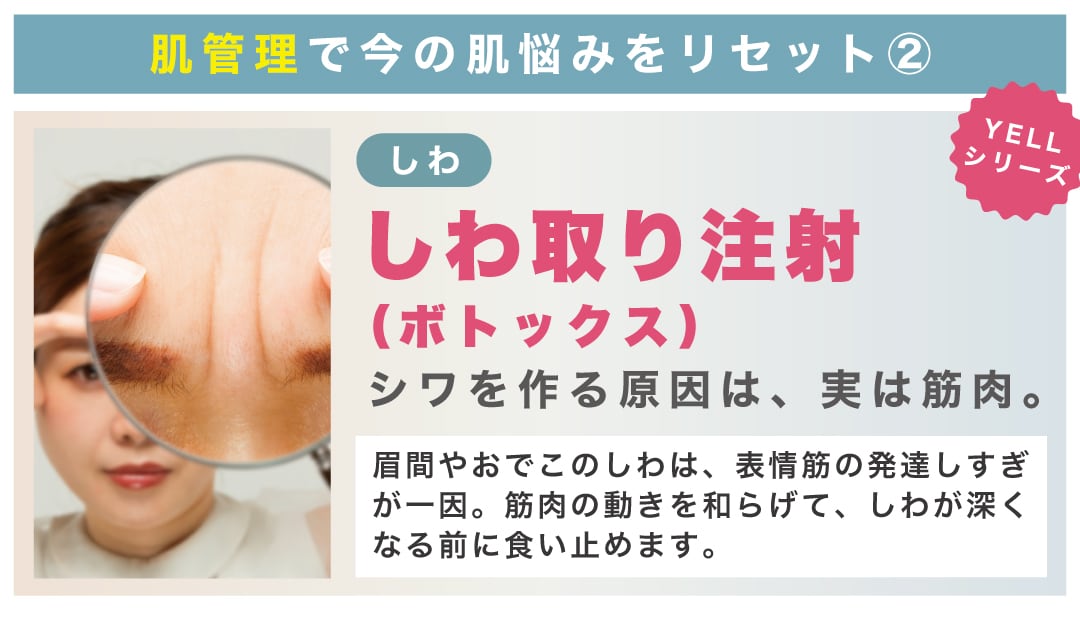 表情ジワが気になるなら「しわ取り注射」