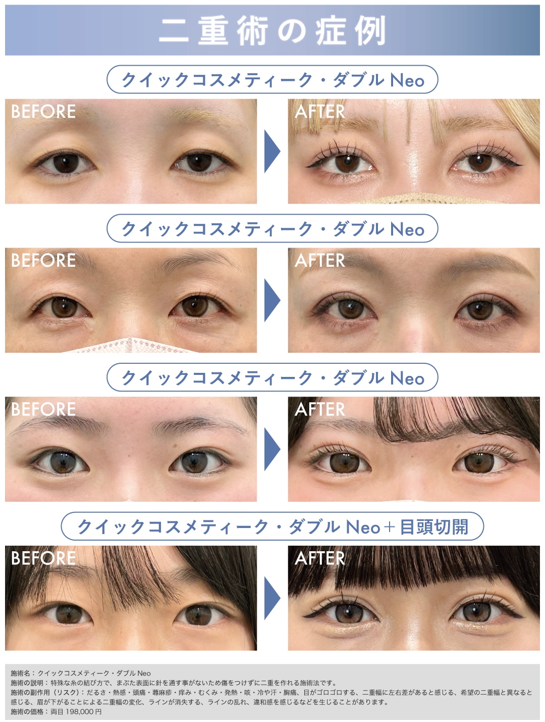 術前と術後１ヶ月の症例です📸