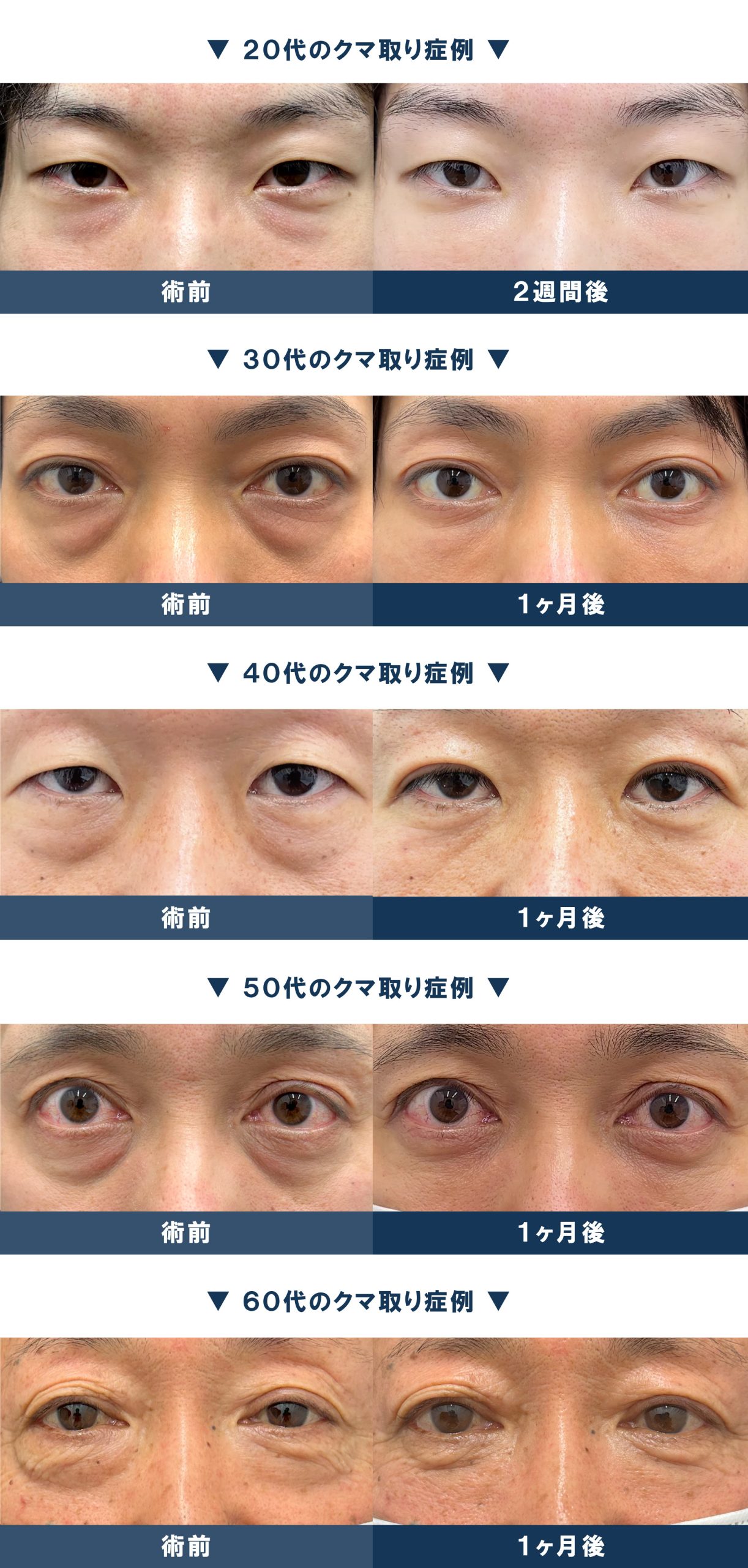 湘南美容外科メンズの真相！2026年評判とヒゲ脱毛・二重の費用を徹底調査