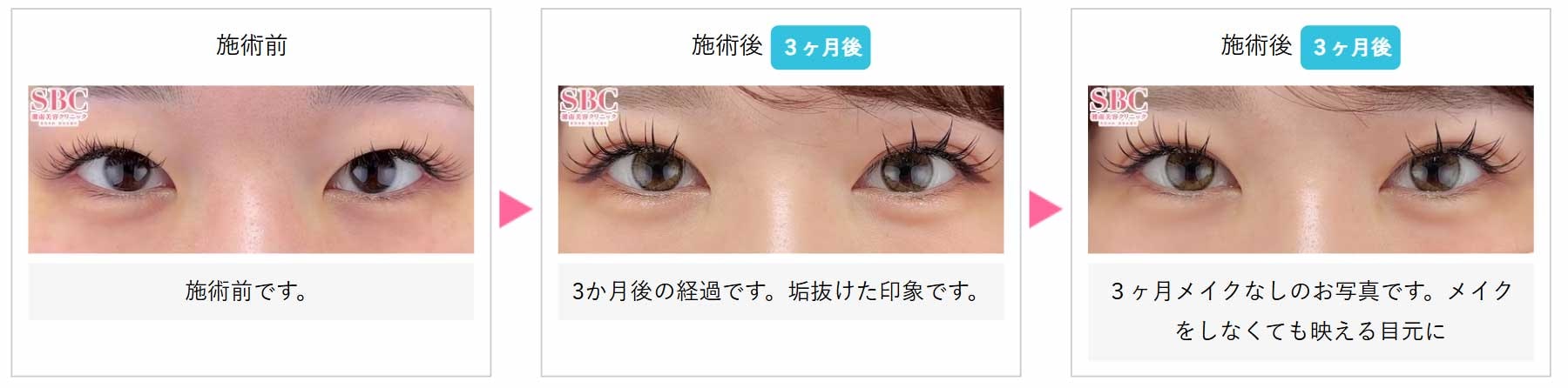 湘南美容クリニック 金澤紀臣院長が語る、“切らない選択肢”の可能性