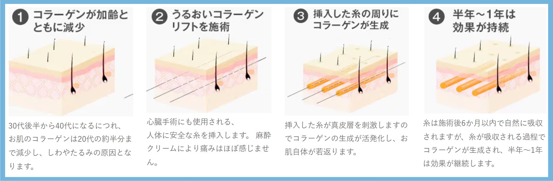 ✅2. コラーゲン生成でこけ感を補正、卵型フェイスラインへ
