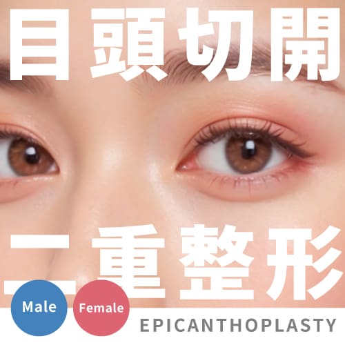 【医師監修】蒙古ひだが気になるあなたへ｜切らずに叶える理想の二重と、後悔しない目頭切開の選び方【東京エリア｜湘南美容クリニック上野院】