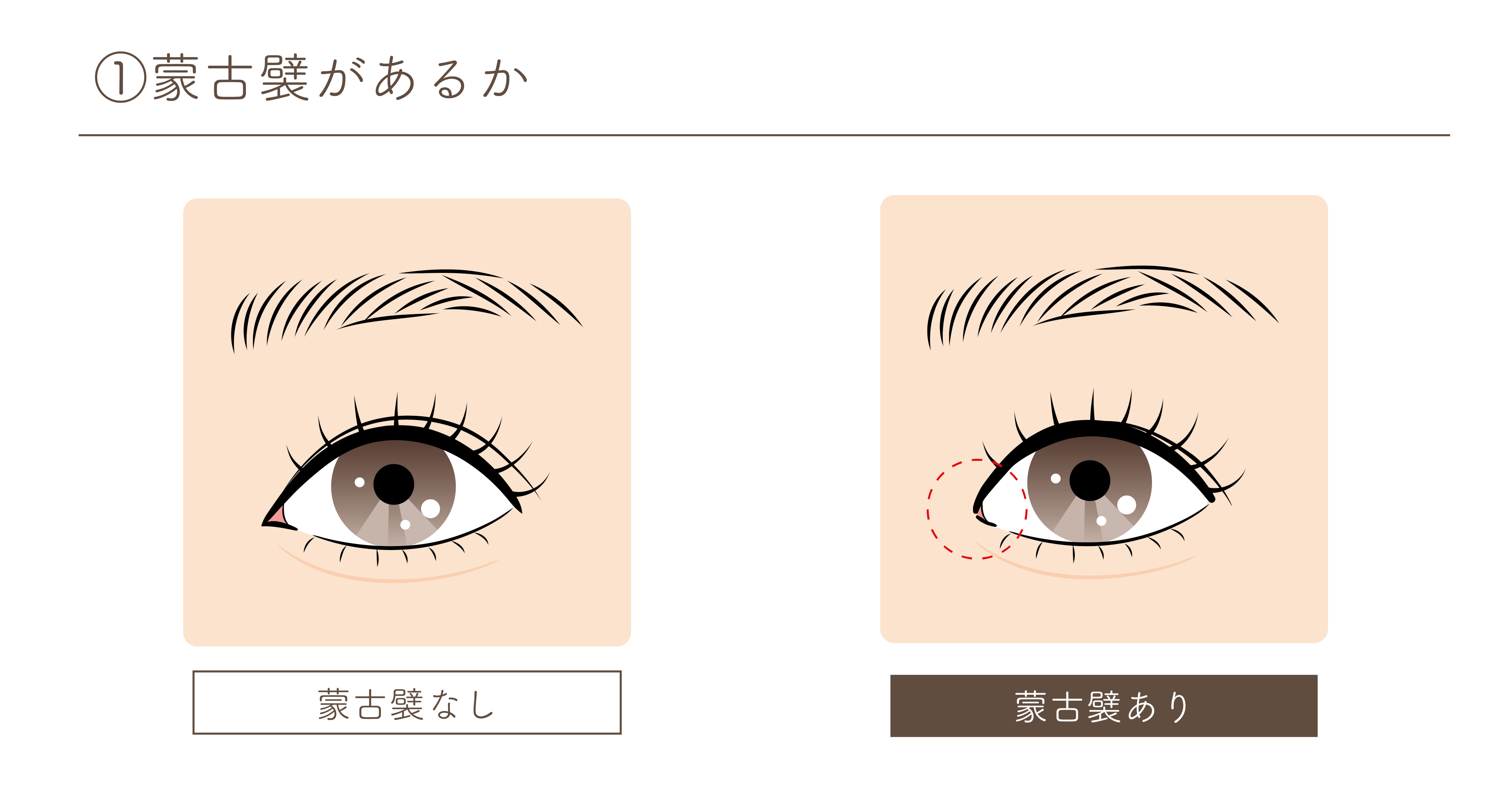 蒙古襞があるかどうか