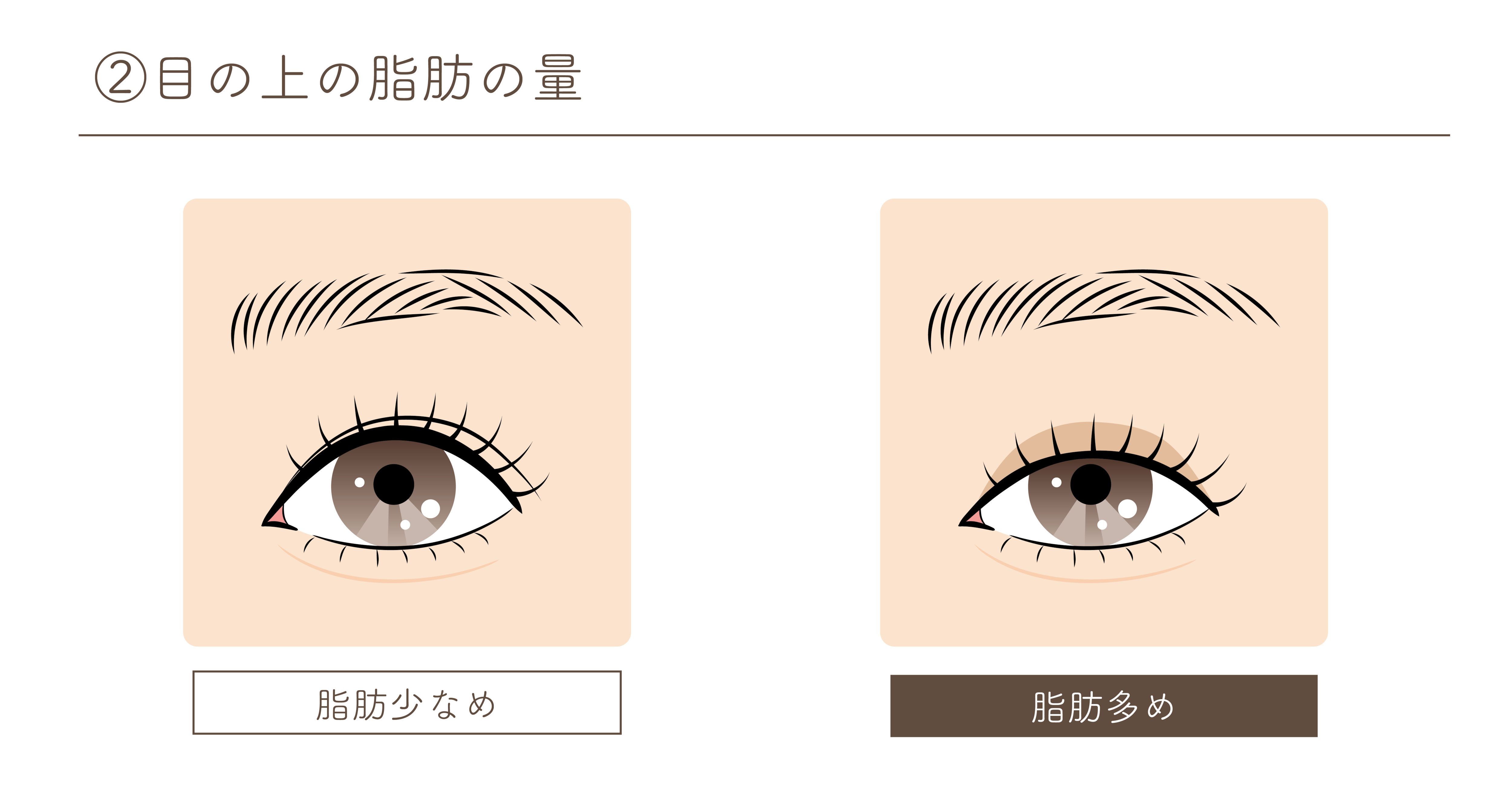 まぶたの脂肪の量について