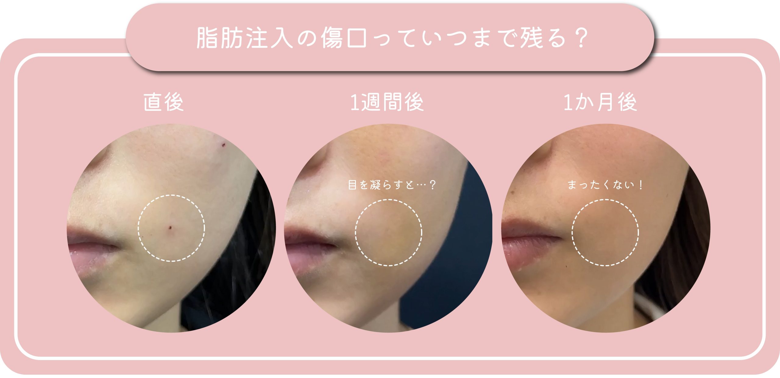 気になる傷口は？