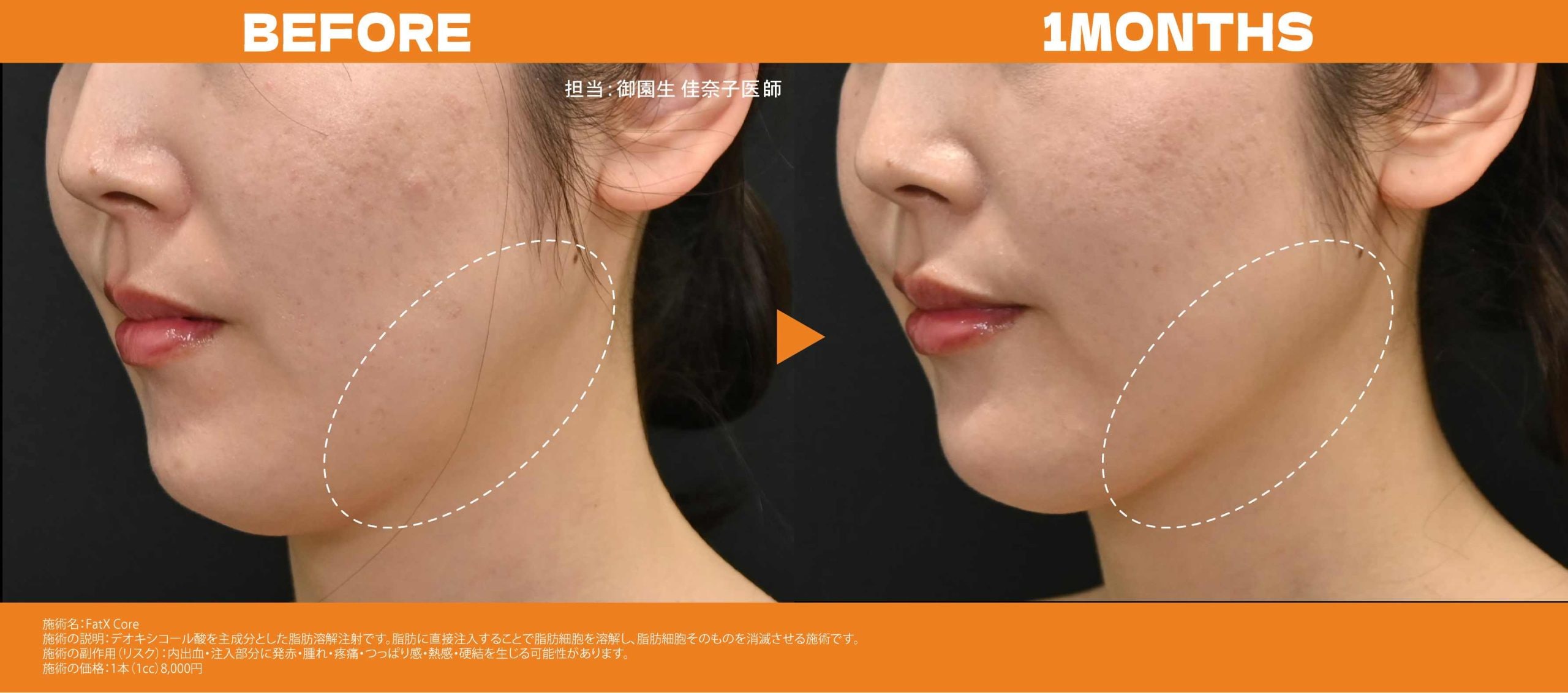fatxcoreの症例比較