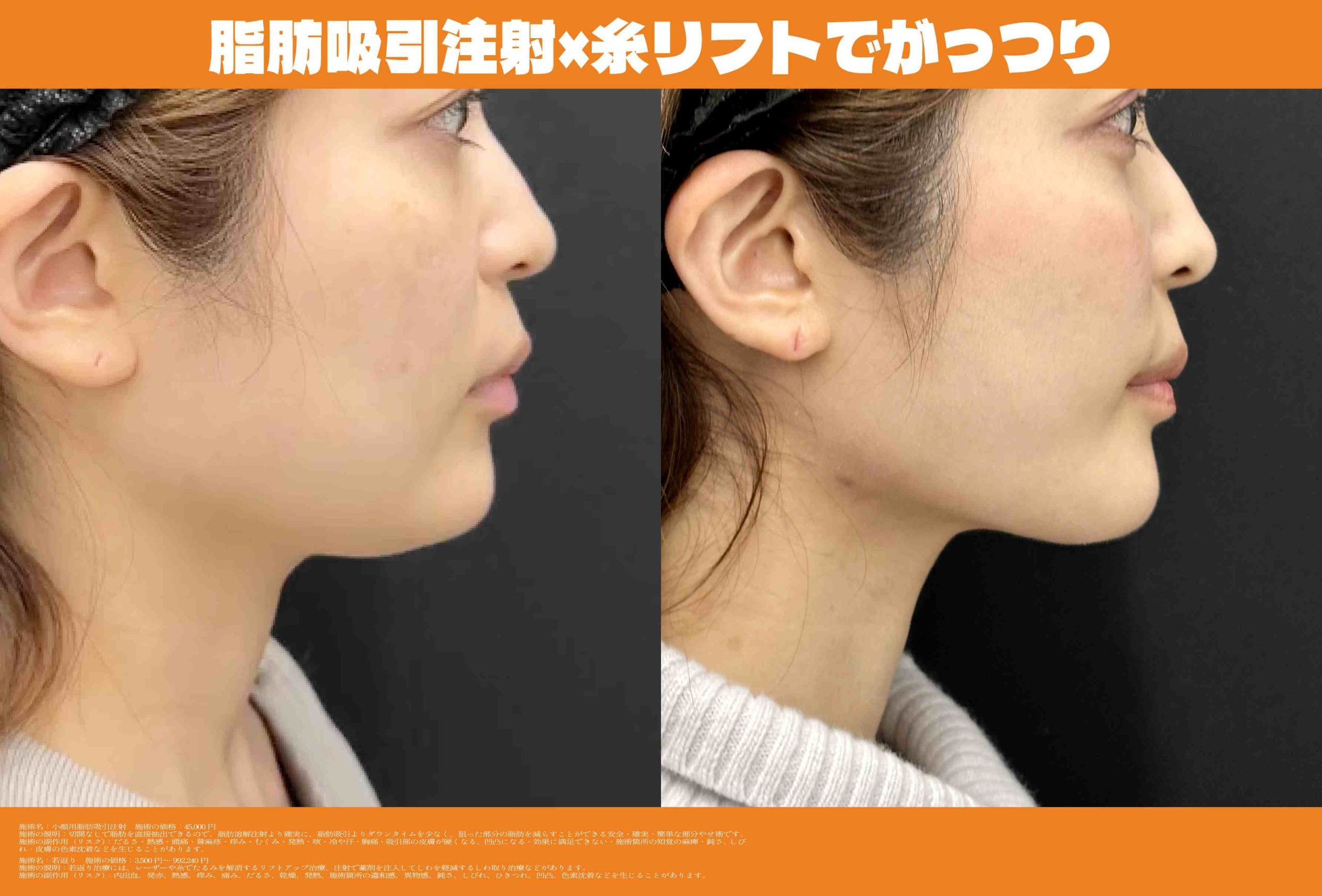 fatxcoreの記事タイトル
