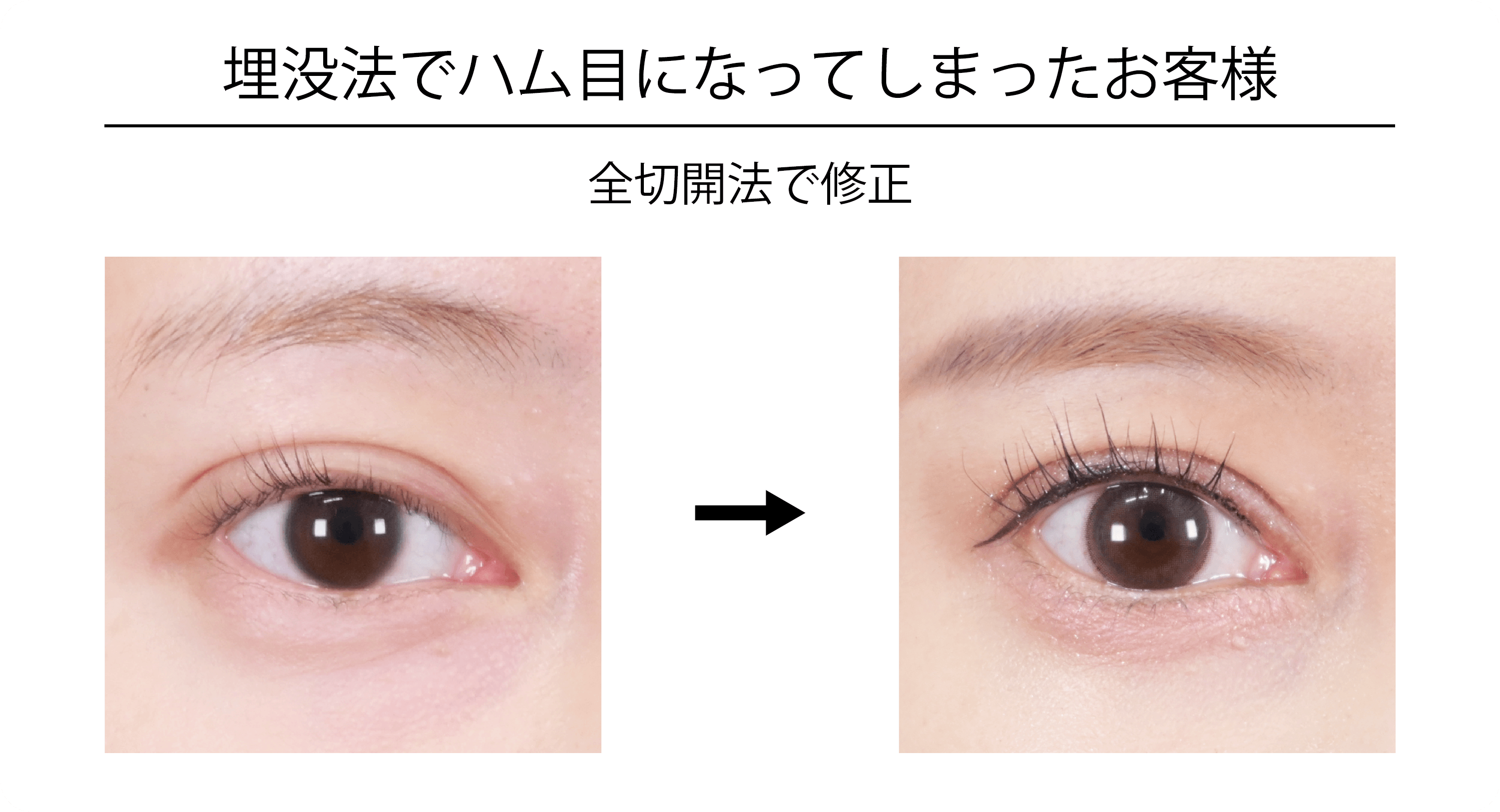 ハム目改善後のイメージ画像1