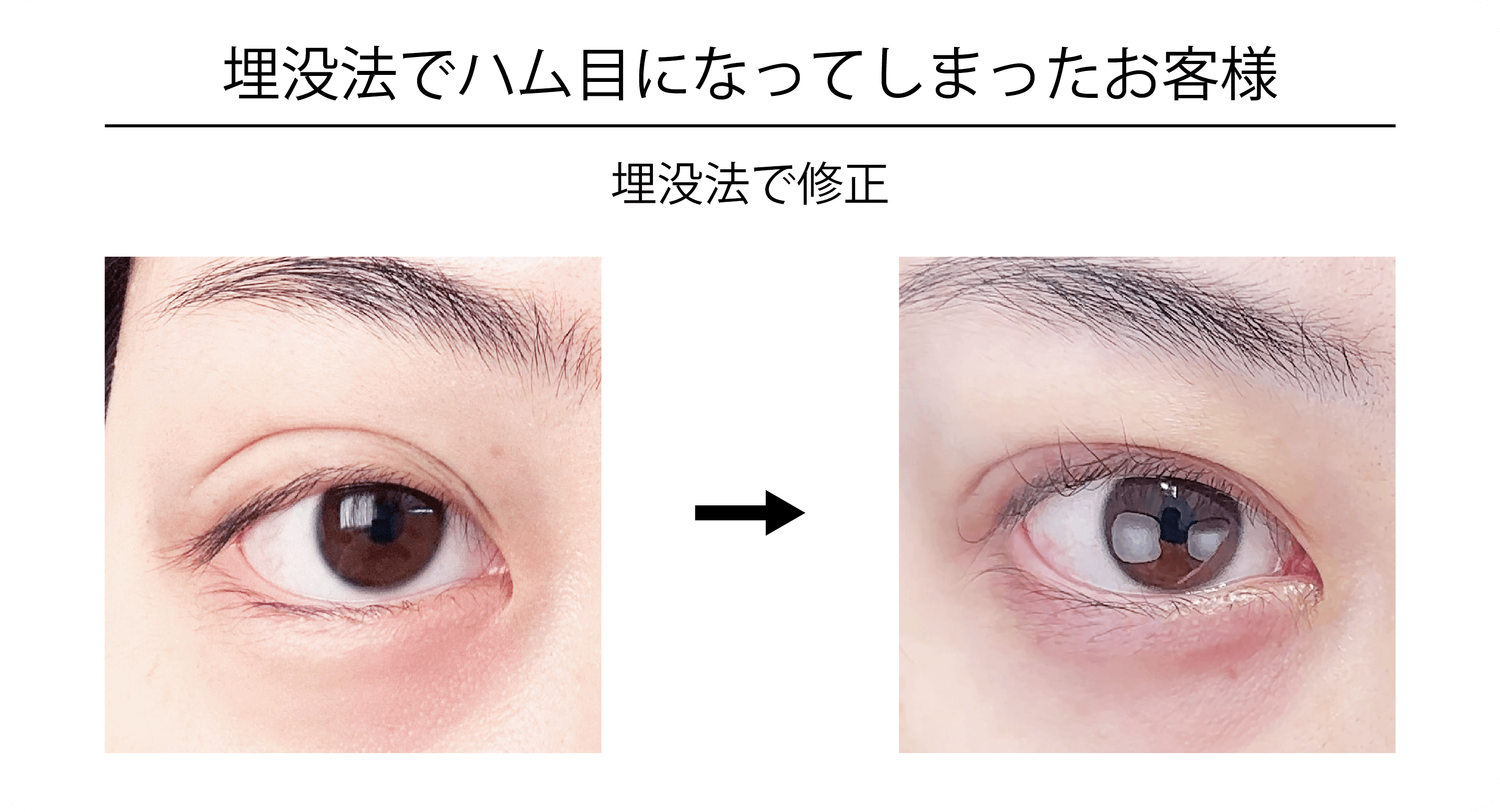 ハム目改善後のイメージ画像2