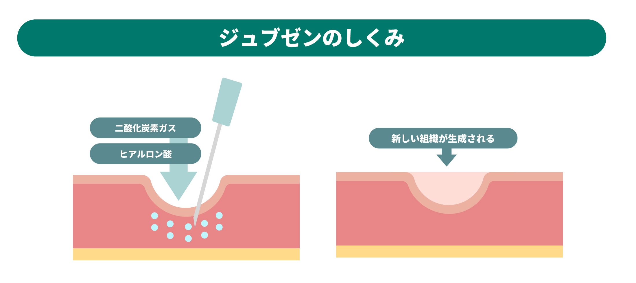 ジュブゼンについての解説